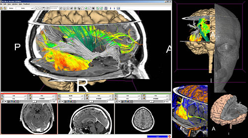 Debrecen slicer 01.jpg