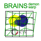 Registration BRAINSdemonwarp.png