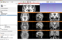 Example snapshot of compareview