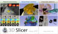 Slicer4Announcement-HiRes crop.png