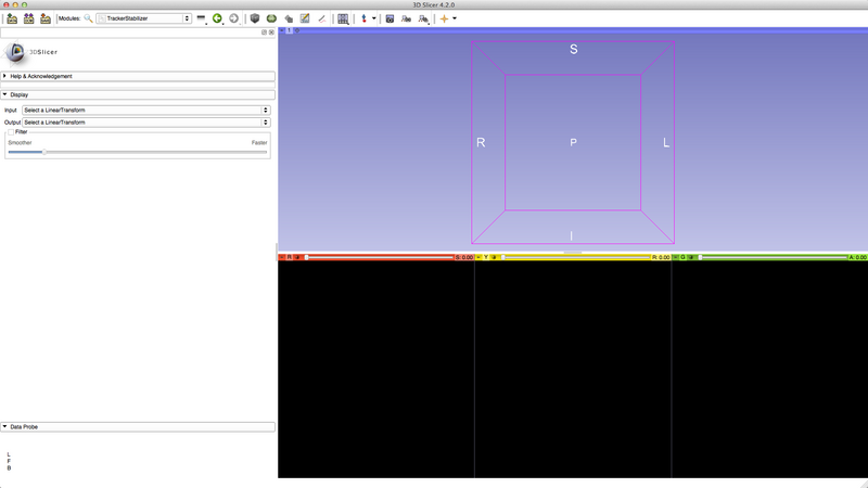 File:Slicer4-TrackerStabilizer-GUI.png