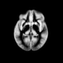 EMSegmenter MRI-Human-Brain GM 420x420.png