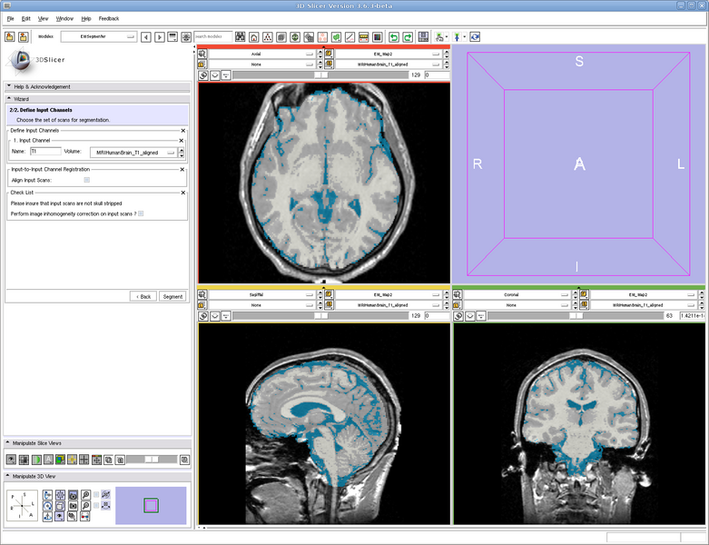 File:EMSegmenter-Simple-Mode.png