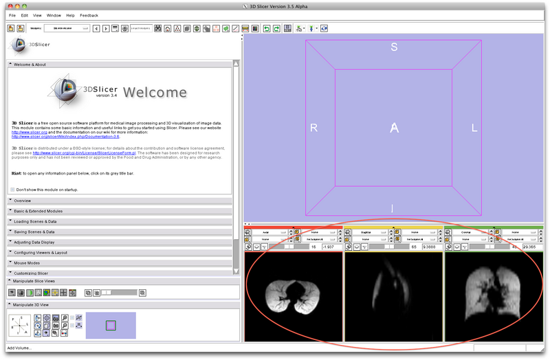 File:MRIBiasFieldCorrection Slicer3.6 Documentation 03.png