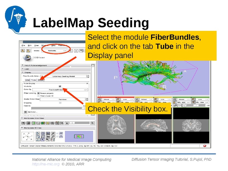 File:DiffusionMRITutorial Slicer3.6 SPujol.pdf