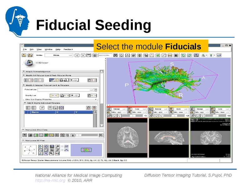 File:DiffusionMRITutorial Slicer3.6 SPujol.pdf