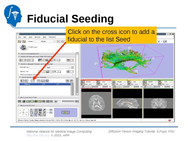 File:DiffusionMRITutorial Slicer3.6 SPujol.pdf