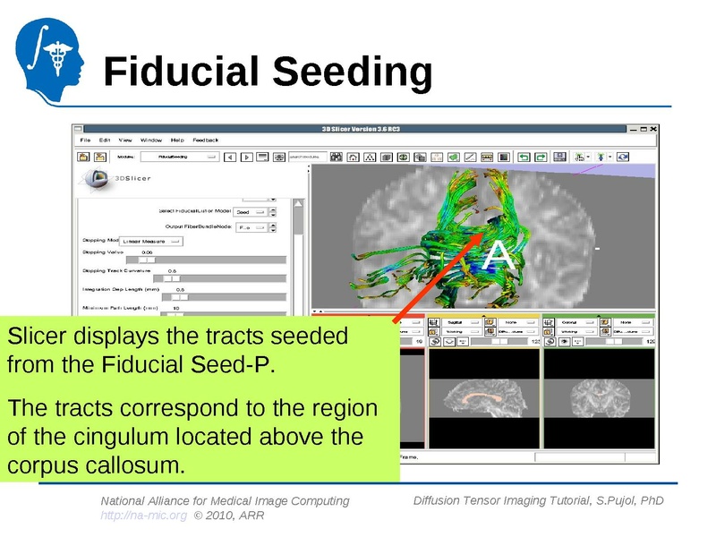 File:DiffusionMRITutorial Slicer3.6 SPujol.pdf