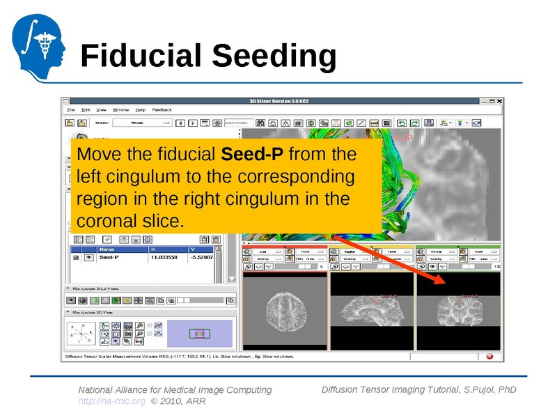 File:DiffusionMRITutorial Slicer3.6 SPujol.pdf