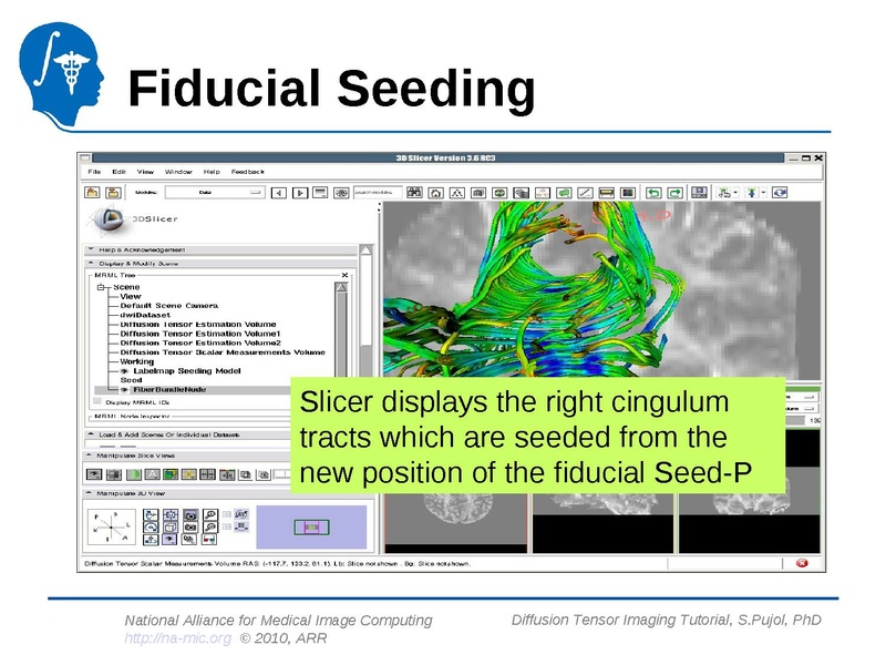 File:DiffusionMRITutorial Slicer3.6 SPujol.pdf