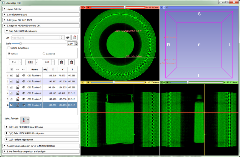 File:GelDosimetry Step3 LandmarkRegistration.png