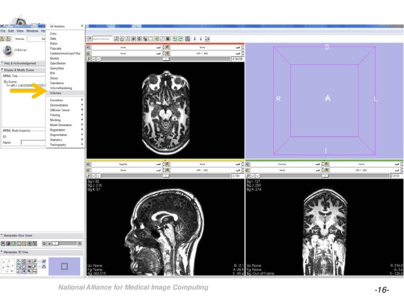 File:OrbitSegmentationTutorial.pdf