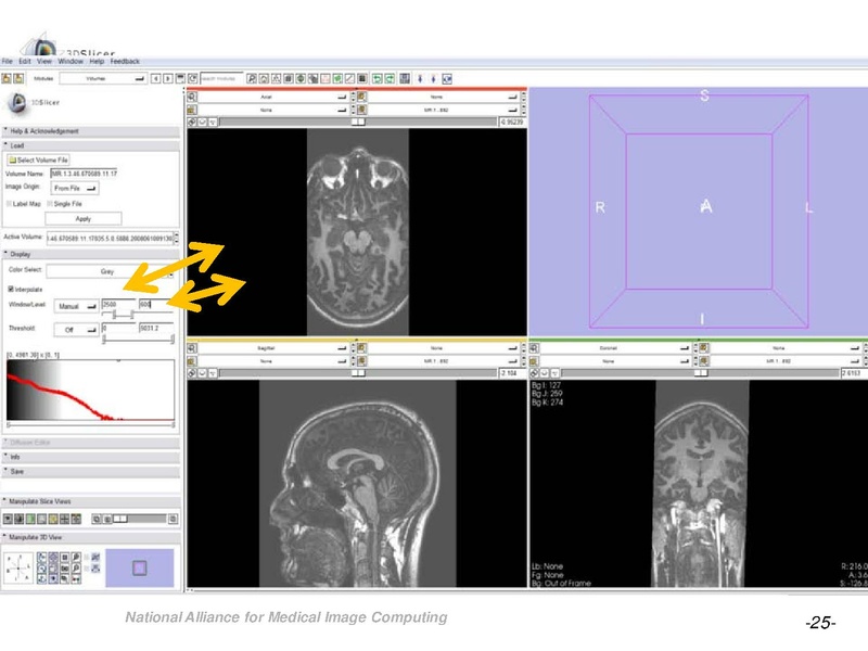 File:OrbitSegmentationTutorial.pdf