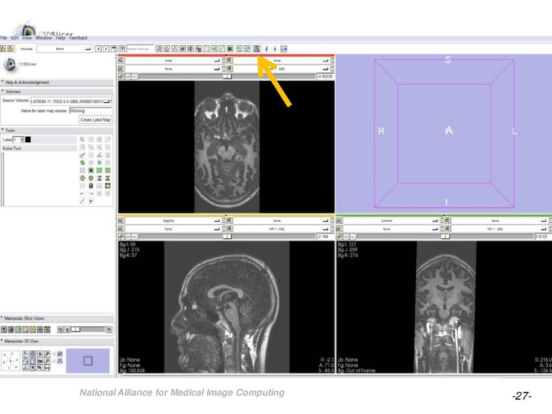 File:OrbitSegmentationTutorial.pdf