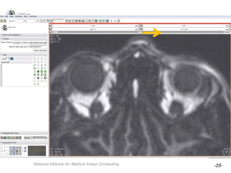 File:OrbitSegmentationTutorial.pdf