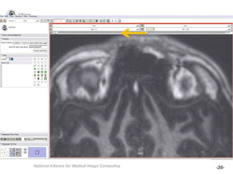File:OrbitSegmentationTutorial.pdf