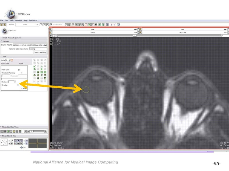 File:OrbitSegmentationTutorial.pdf