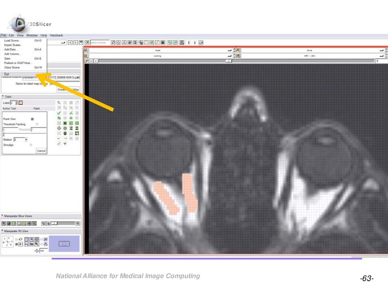 File:OrbitSegmentationTutorial.pdf