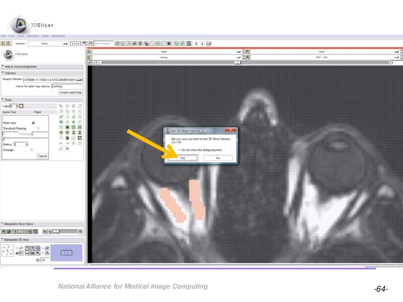 File:OrbitSegmentationTutorial.pdf