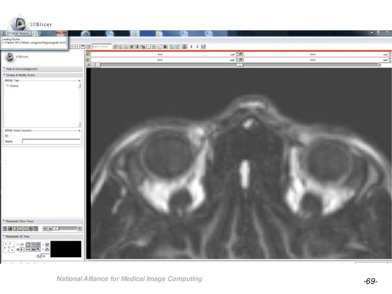 File:OrbitSegmentationTutorial.pdf