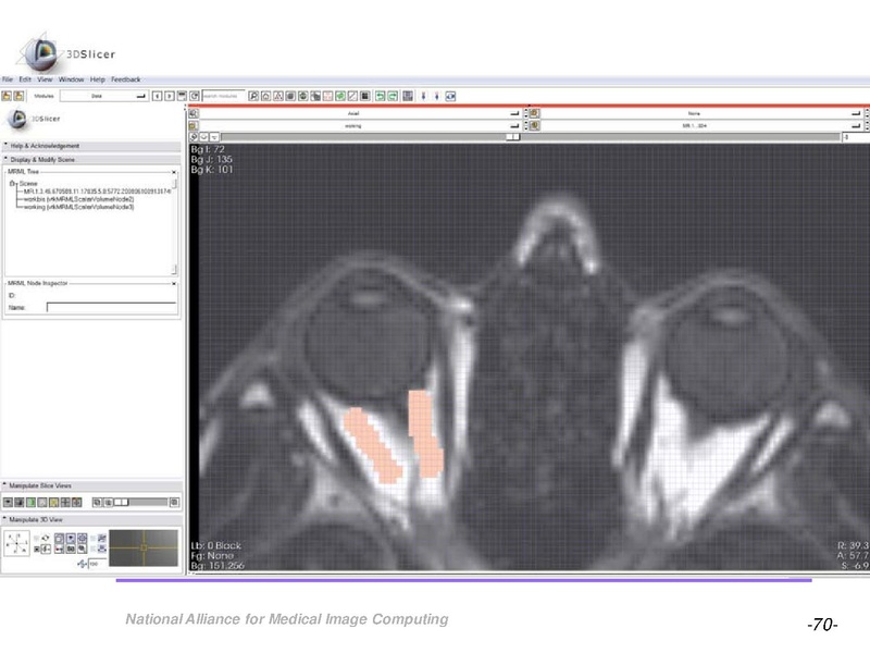 File:OrbitSegmentationTutorial.pdf