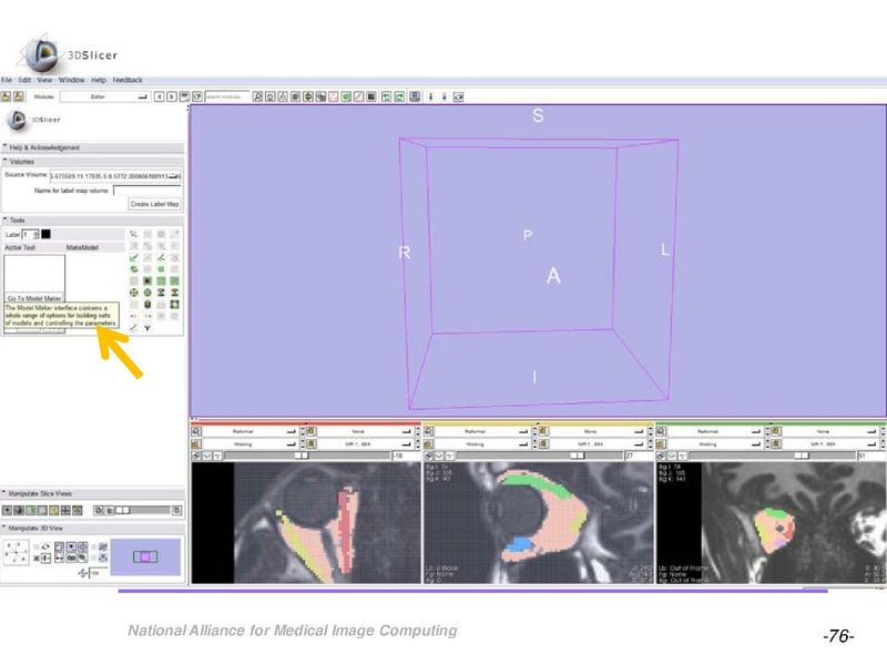 File:OrbitSegmentationTutorial.pdf