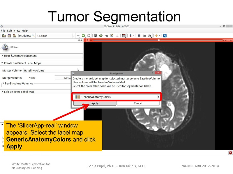 File:WhiteMatterExplorationTutorial SoniaPujol 2013.pdf