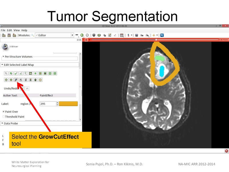 File:WhiteMatterExplorationTutorial SoniaPujol 2013.pdf