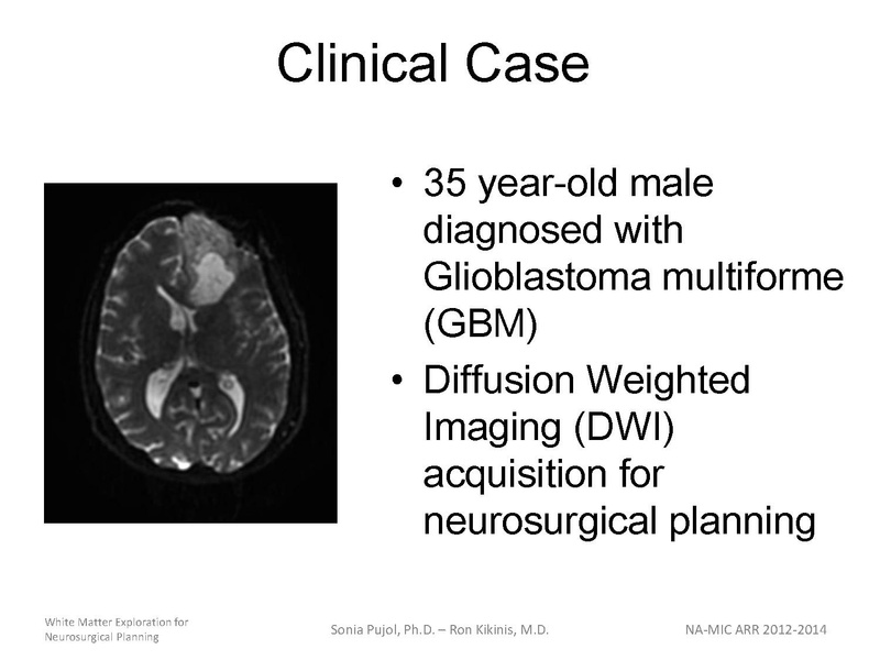 File:WhiteMatterExplorationTutorial SoniaPujol 2013.pdf