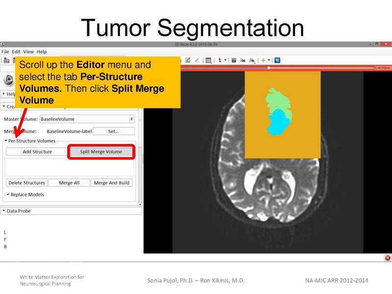 File:WhiteMatterExplorationTutorial SoniaPujol 2013.pdf