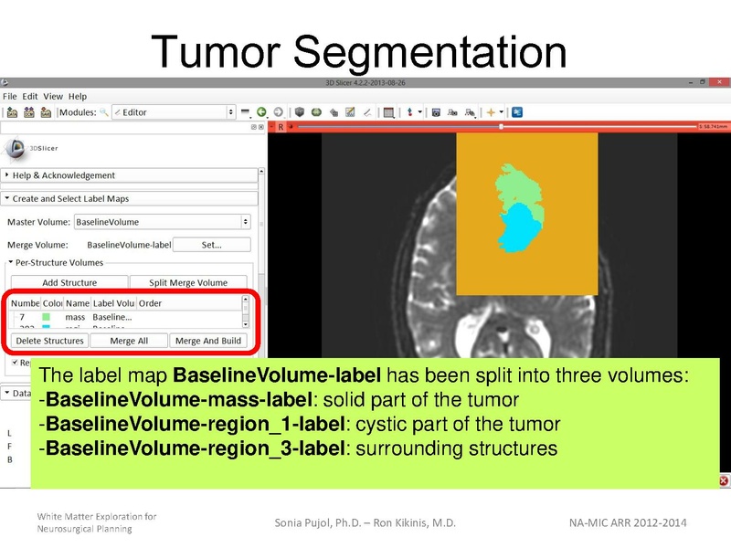 File:WhiteMatterExplorationTutorial SoniaPujol 2013.pdf