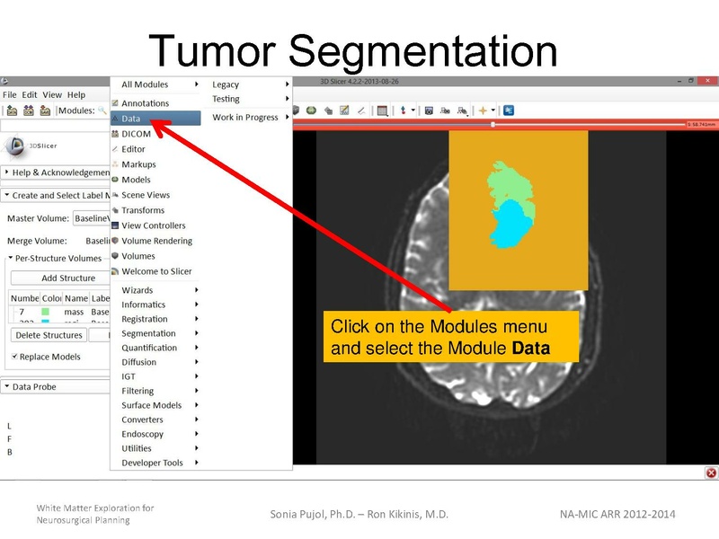 File:WhiteMatterExplorationTutorial SoniaPujol 2013.pdf