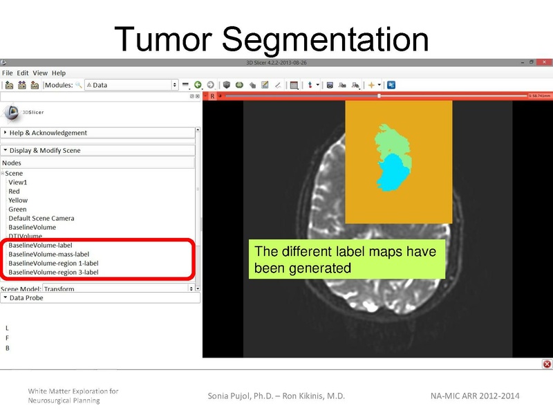 File:WhiteMatterExplorationTutorial SoniaPujol 2013.pdf