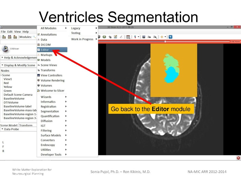 File:WhiteMatterExplorationTutorial SoniaPujol 2013.pdf