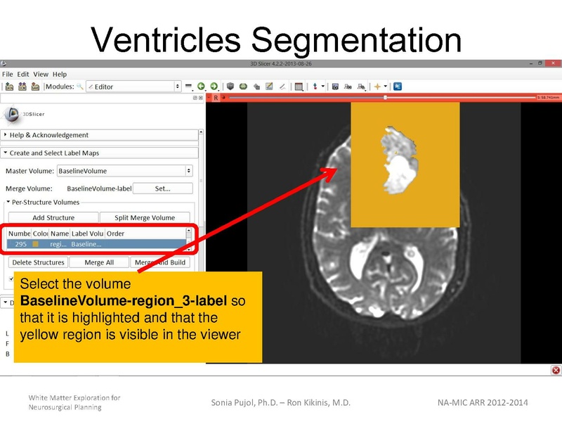 File:WhiteMatterExplorationTutorial SoniaPujol 2013.pdf