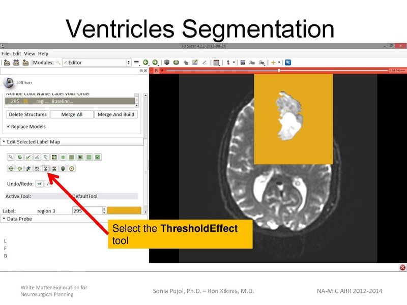 File:WhiteMatterExplorationTutorial SoniaPujol 2013.pdf