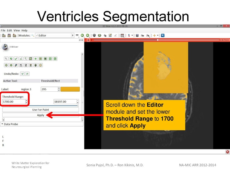 File:WhiteMatterExplorationTutorial SoniaPujol 2013.pdf