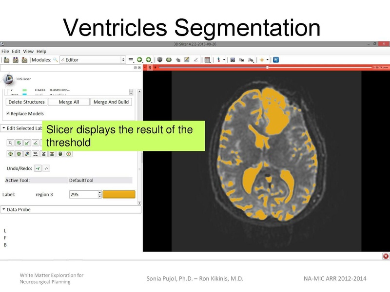 File:WhiteMatterExplorationTutorial SoniaPujol 2013.pdf