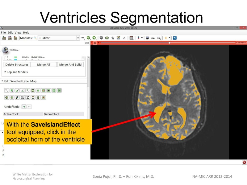 File:WhiteMatterExplorationTutorial SoniaPujol 2013.pdf