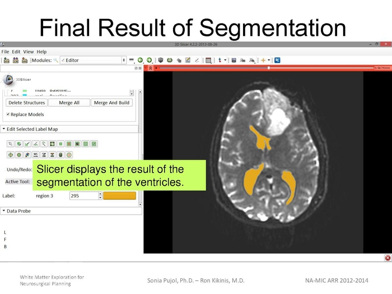 File:WhiteMatterExplorationTutorial SoniaPujol 2013.pdf