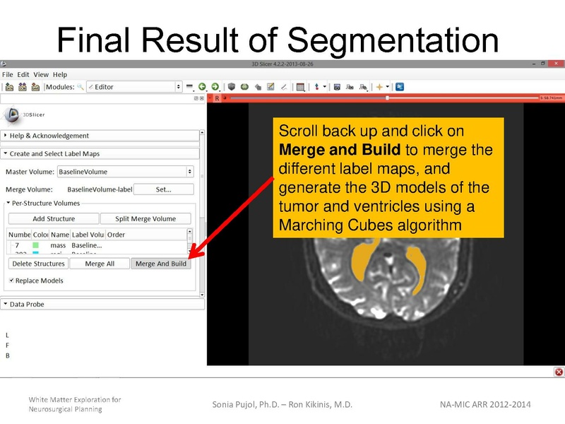 File:WhiteMatterExplorationTutorial SoniaPujol 2013.pdf