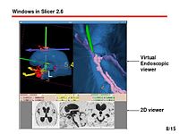 Slicer igt img10.jpg