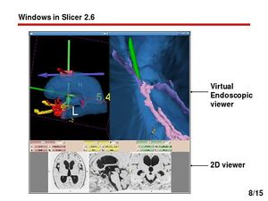 Slicer igt img10.jpg