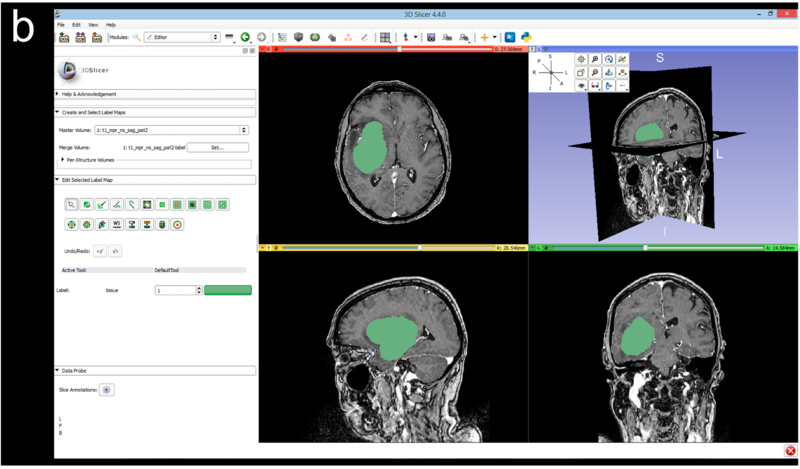 File:Fyllingen- PLoSOne2016-fig2.PNG