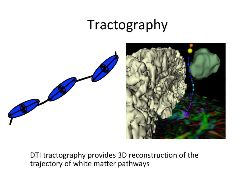 File:DiffusionMRIanalysisTutorial Slicer4.5 SoniaPujol.pdf