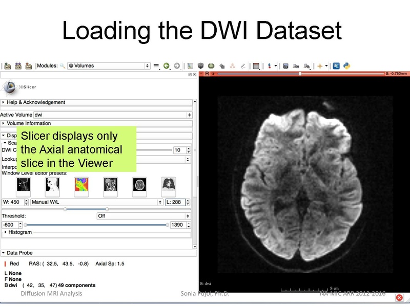 File:DiffusionMRIanalysisTutorial Slicer4.5 SoniaPujol.pdf