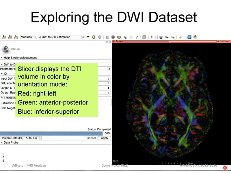 File:DiffusionMRIanalysisTutorial Slicer4.5 SoniaPujol.pdf