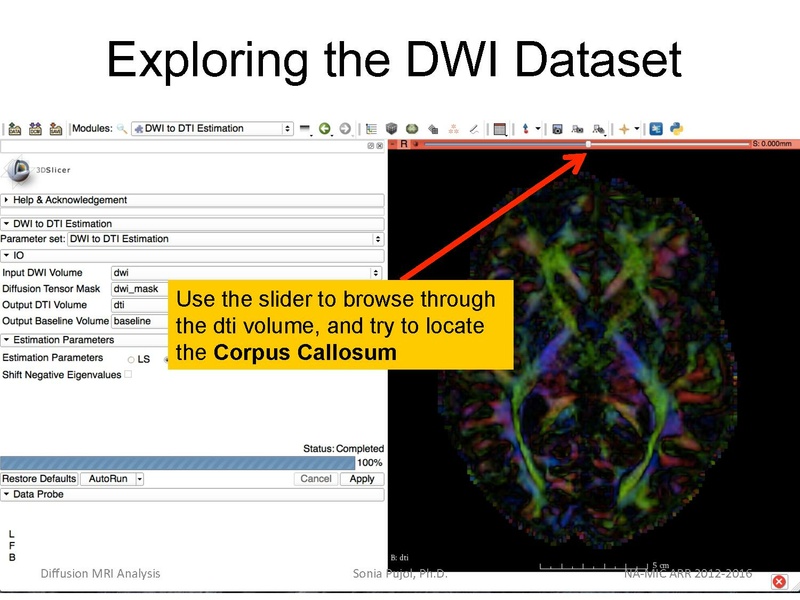 File:DiffusionMRIanalysisTutorial Slicer4.5 SoniaPujol.pdf