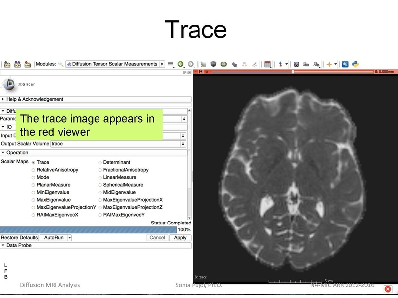 File:DiffusionMRIanalysisTutorial Slicer4.5 SoniaPujol.pdf