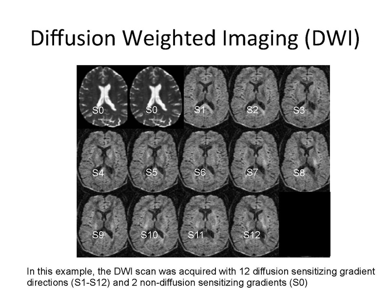File:DiffusionMRIanalysisTutorial Slicer4.5 SoniaPujol.pdf